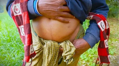 বাংলাদেশে ‘এক কিডনির গ্রাম’, দালাল চক্রের ফাঁদে নিঃস্ব দরিদ্র মানুষ