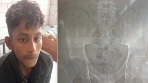 পেটভর্তি ইয়াবাসহ শার্শার মাসুদ রানা আটক