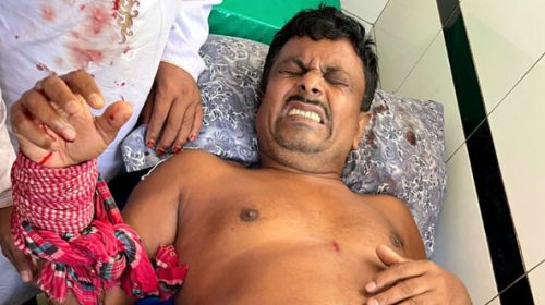 ভাঙ্গায় মামলা তুলে না নেয়ায় বাদীসহ ৪ জনকে কুপিয়ে জখম